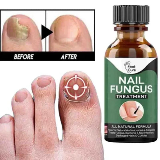 Fast Nail Fungal Treatments Nail Repair Essences Serum Care Treatments Foot Nail Fungus Removal Gel ₨92