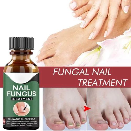 Fast Nail Fungal Treatments Nail Repair Essences Serum Care Treatments Foot Nail Fungus Removal Gel ₨92