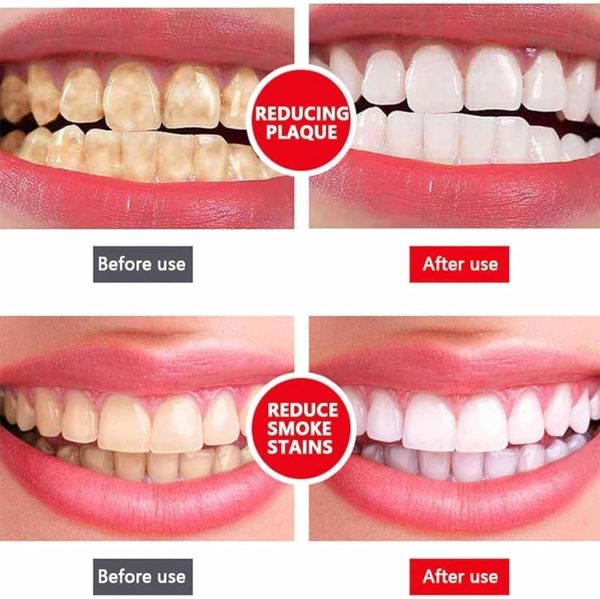 Yayashi Sp-4 Ultra Whitening Toothpaste Probiotic Stain Remover 120gm /nano Toothbrush Protects Gums Freshens Breath, For Everyone